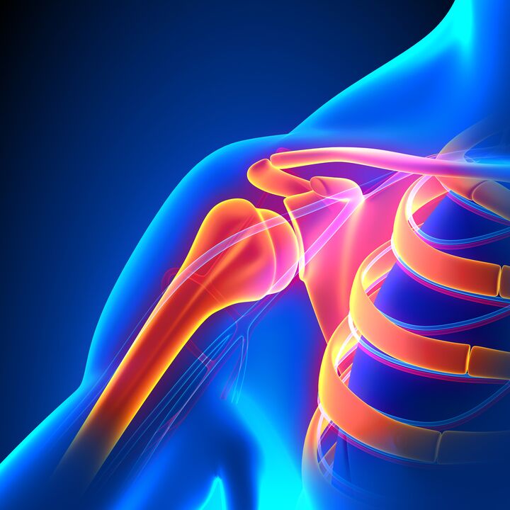 hogyan gyógyítható az osteochondrosis otthon)